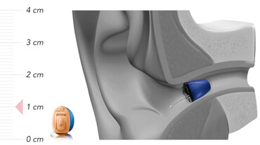 ΕΝΔΩΤΙΑΙΟ ΣΥΣΤΗΜΑ ΑΚΟΗΣ